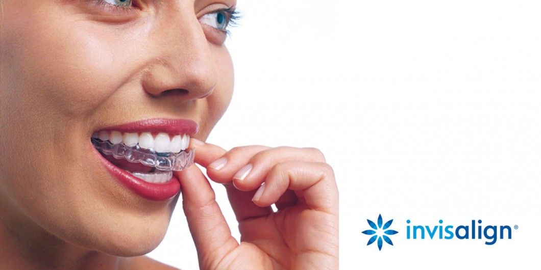 180 clinic | تقويم الأسنان